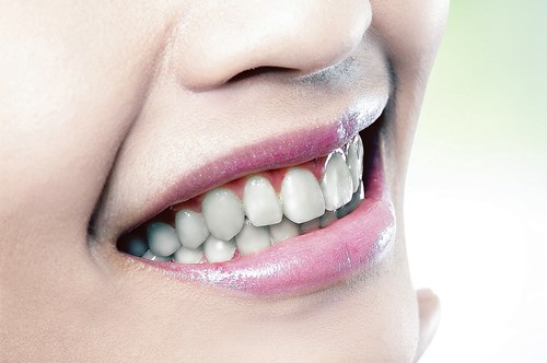牙齿种植是什么手术的优点有哪些