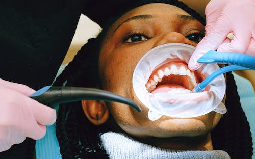 牙龈肿痛吃什么药如何预防牙龈肿痛