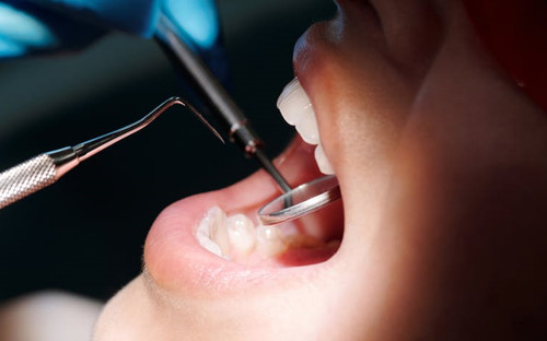 长智齿牙龈肿痛的原因有哪些怎么快速消肿止痛