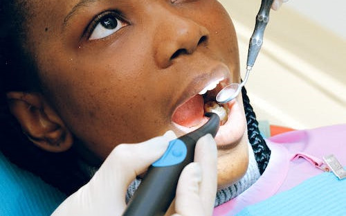 龅牙的分类有哪些龅牙如何自己矫正