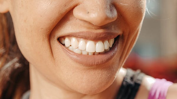 牙齿美白有副作用吗牙黄怎么快速变白